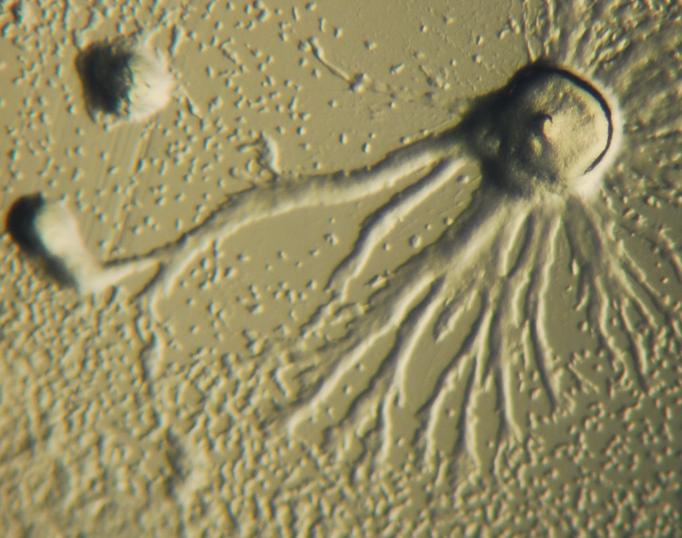 Dictyostelium colony in process of aggregation