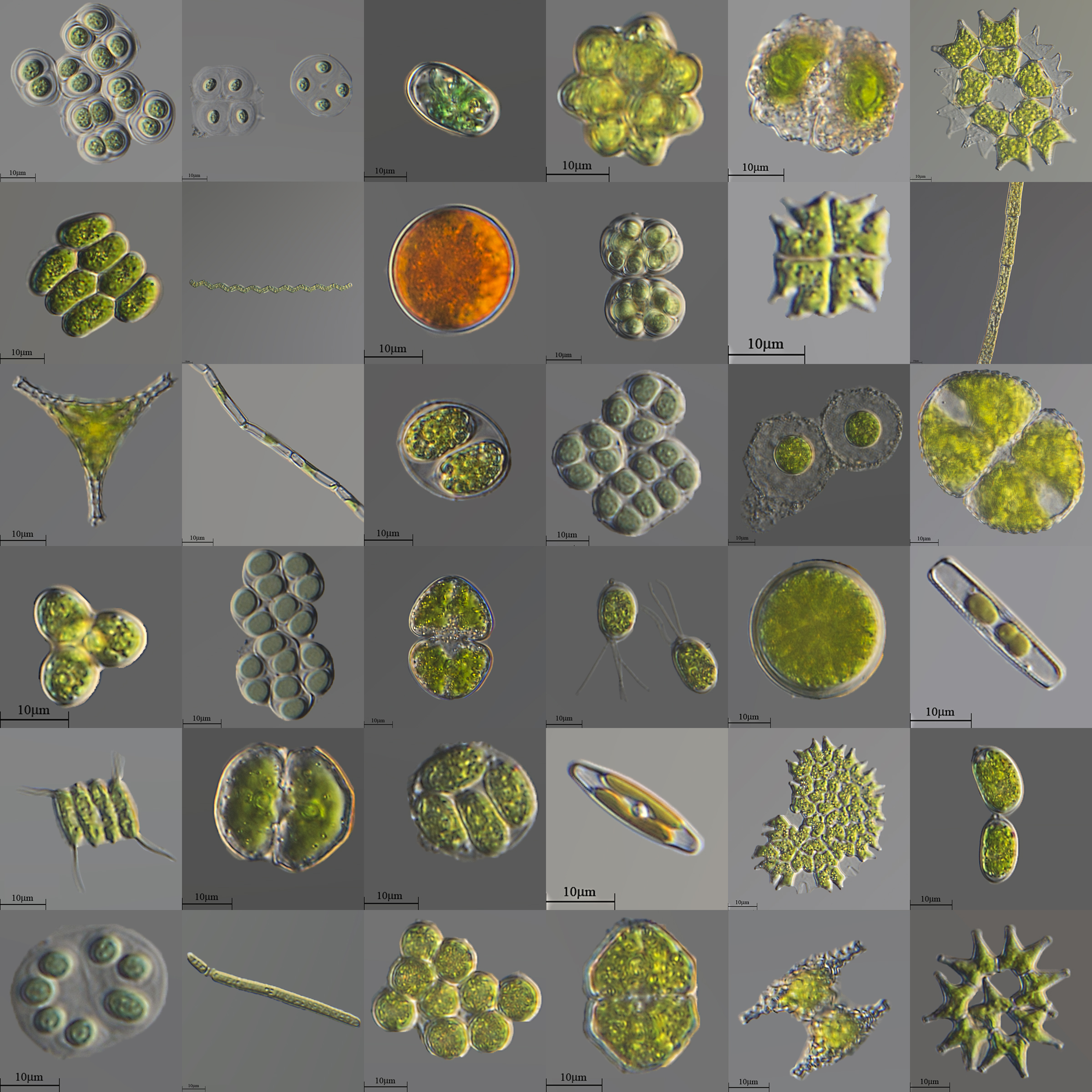 A variety of microscopic unicellular and colonial freshwater algae