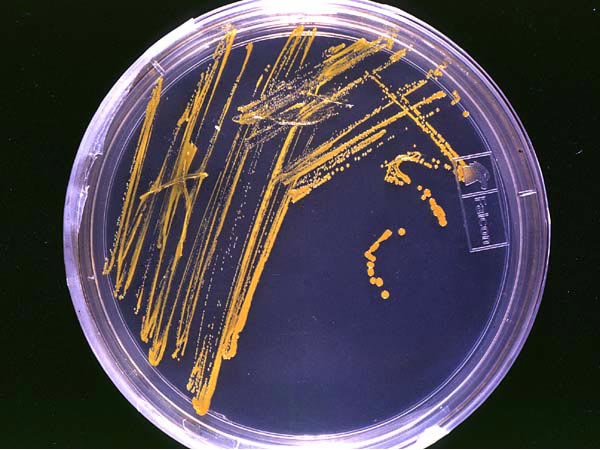 A Petri dish with bacterial colonies on an agar-based growth medium.