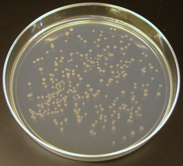 An agar culture of E. coli colonies.