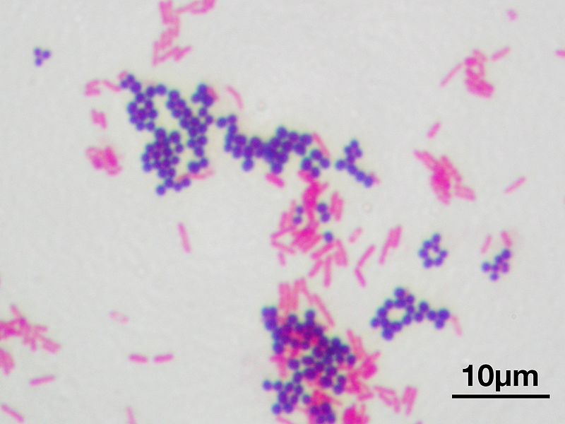 A Gram stain of mixed Staphylococcus aureus (S. aureus ATCC 25923, gram-positive cocci, in purple) and Escherichia coli (E. coli ATCC 11775, gram-negative bacilli, in red), the most common Gram stain reference bacteria