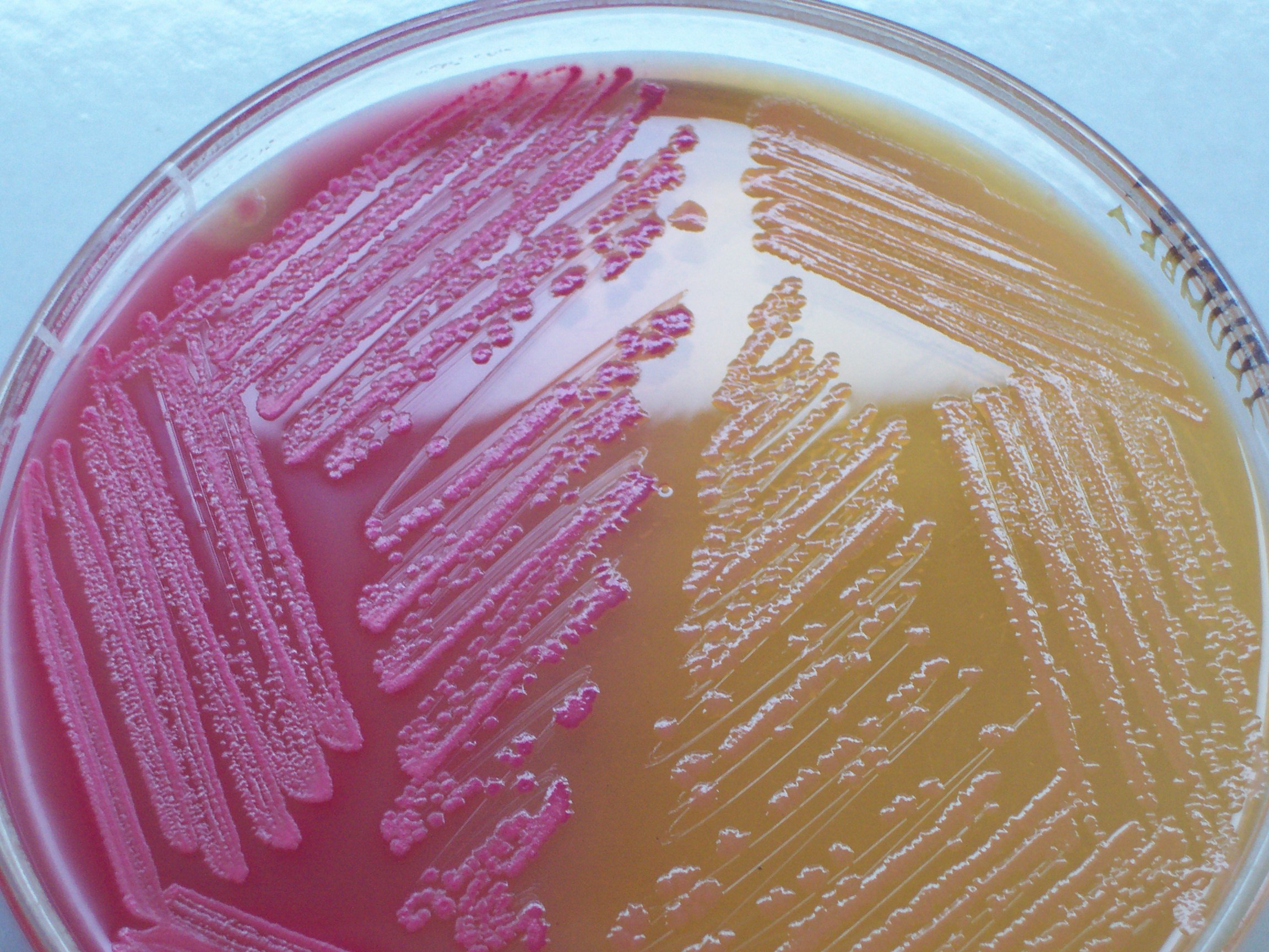MacConkey’s agar showing both lactose and non-lactose fermenting colonies. Lactose fermenting colonies are pink whereas non-lactose fermenting ones are colourless or appear same as the medium.
