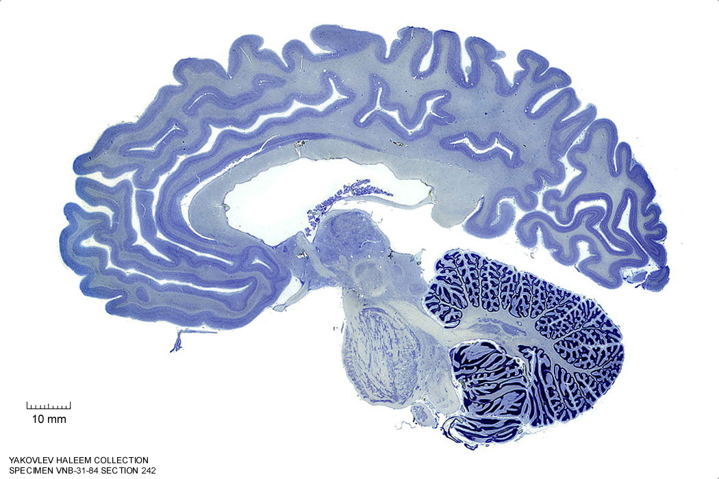 Sagittal section from The Human Brain Atlas at the Michigan State University Brain Biodiveristy Bank which acknowledges their support from the National Science Foundation.