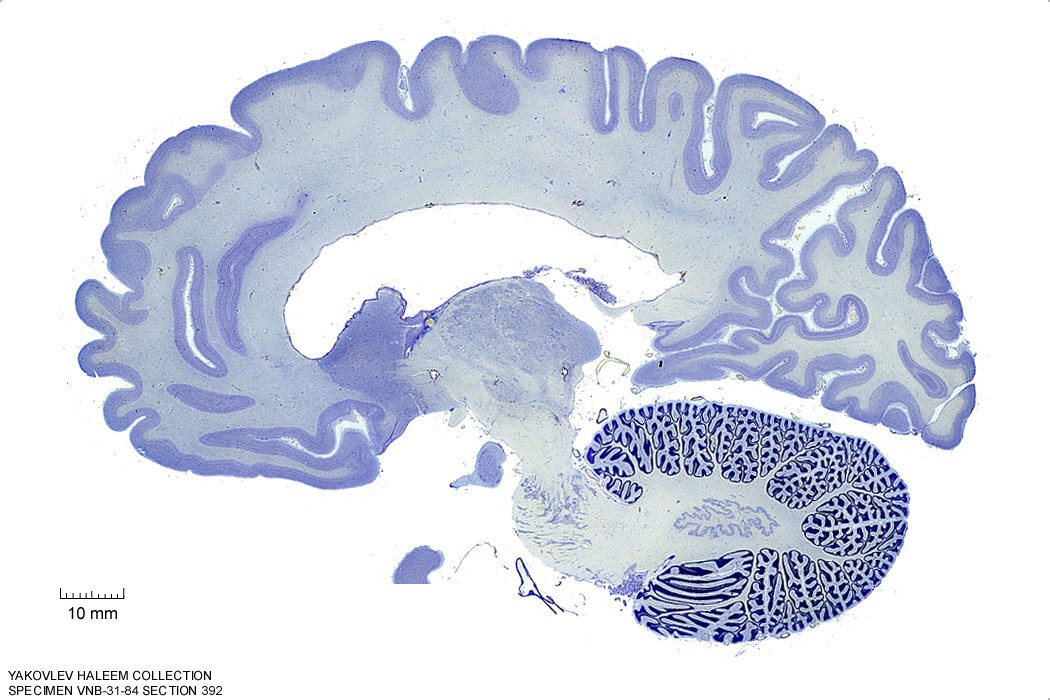 Sagittal section from The Human Brain Atlas at the Michigan State University Brain Biodiveristy Bank which acknowledges their support from the National Science Foundation.