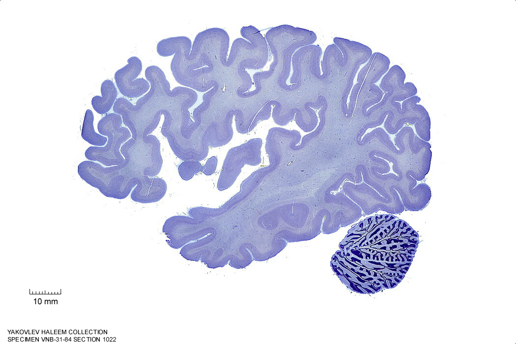 Sagittal section from The Human Brain Atlas at the Michigan State University Brain Biodiveristy Bank which acknowledges their support from the National Science Foundation.