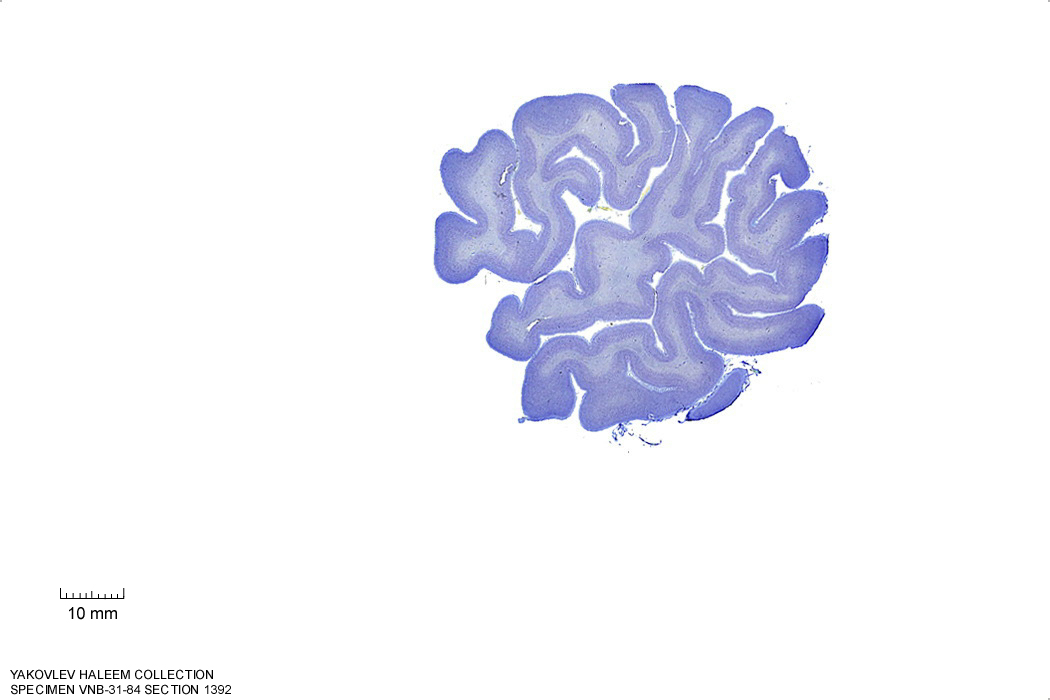 Sagittal section from The Human Brain Atlas at the Michigan State University Brain Biodiveristy Bank which acknowledges their support from the National Science Foundation.