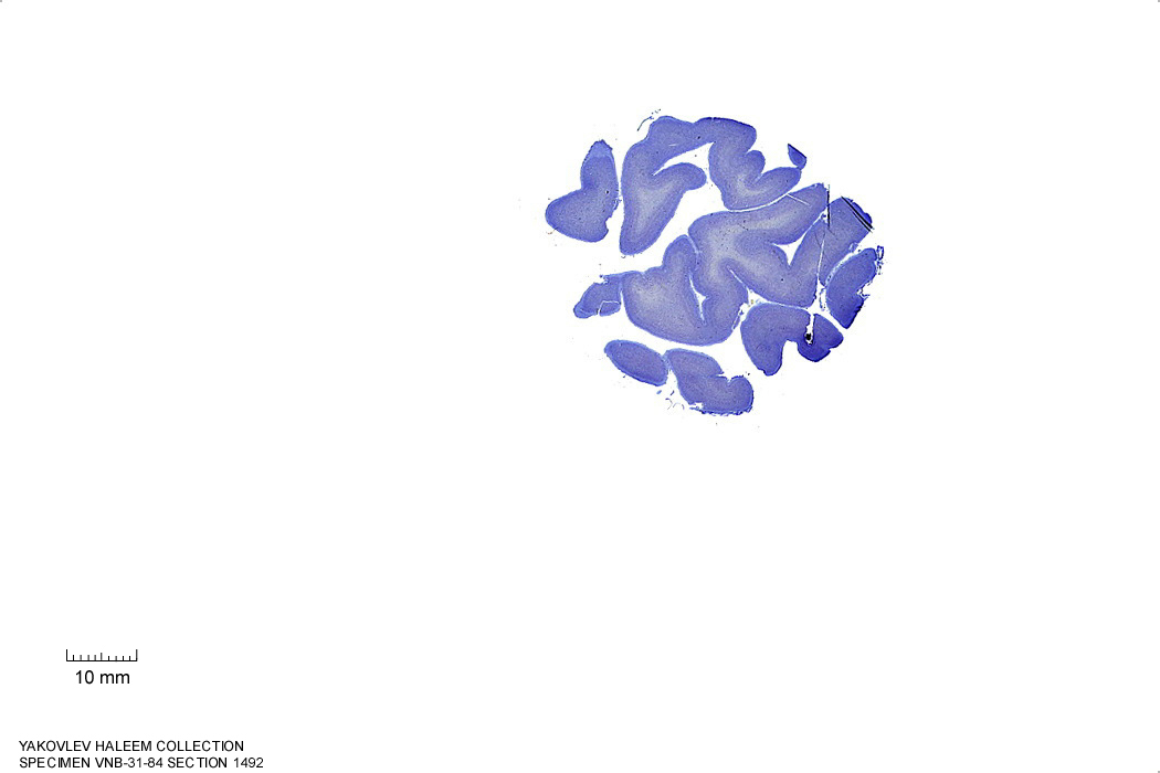 Sagittal section from The Human Brain Atlas at the Michigan State University Brain Biodiveristy Bank which acknowledges their support from the National Science Foundation.