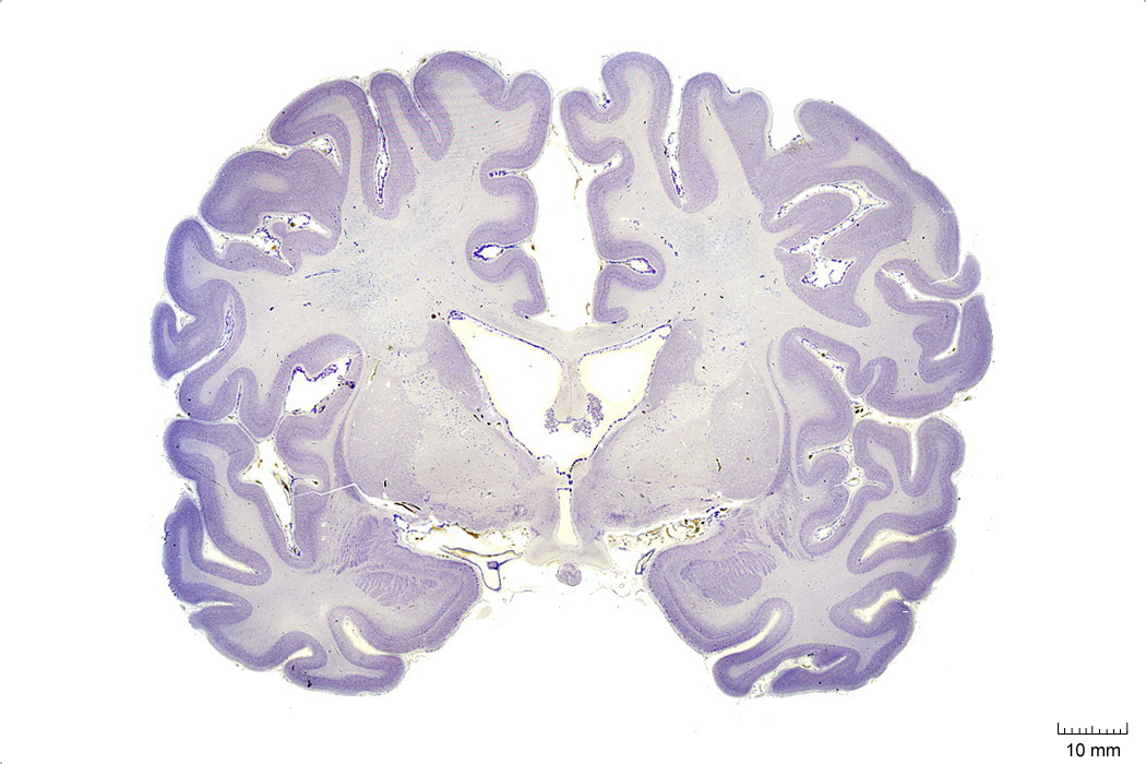 Coronal section from The Human Brain Atlas at the Michigan State University Brain Biodiveristy Bank which acknowledges their support from the National Science Foundation.