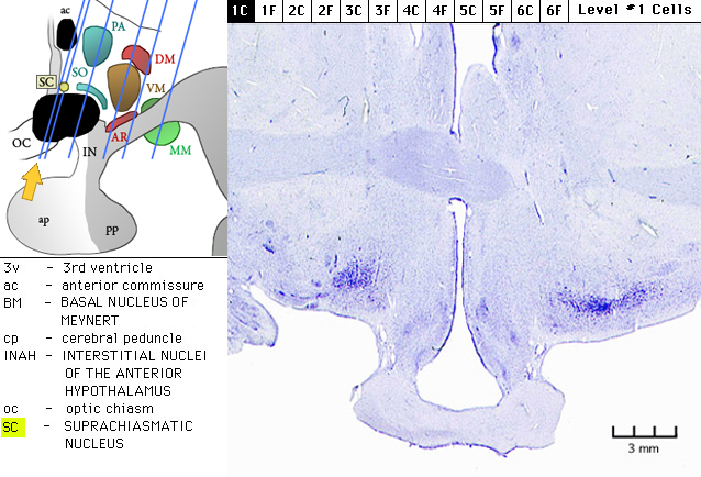 Sagittal section from The Human Brain Atlas at the Michigan State University Brain Biodiveristy Bank which acknowledges their support from the National Science Foundation.