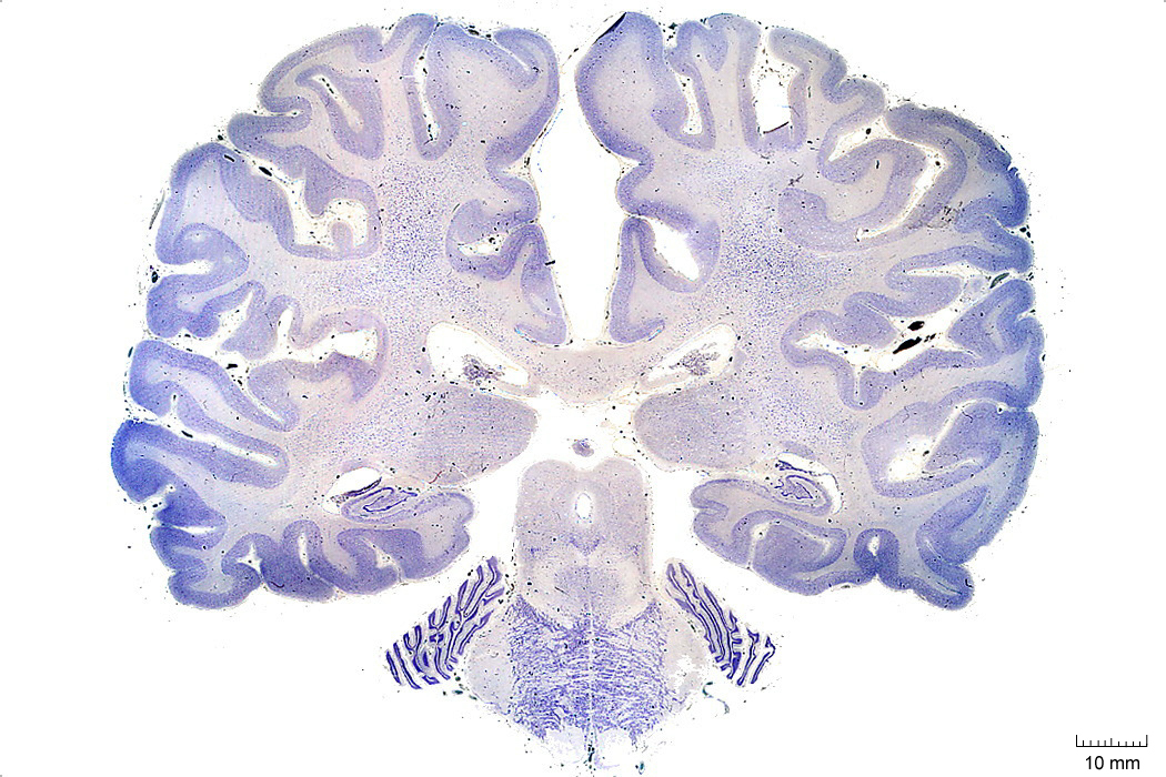 Coronal section from The Human Brain Atlas at the Michigan State University Brain Biodiveristy Bank which acknowledges their support from the National Science Foundation.