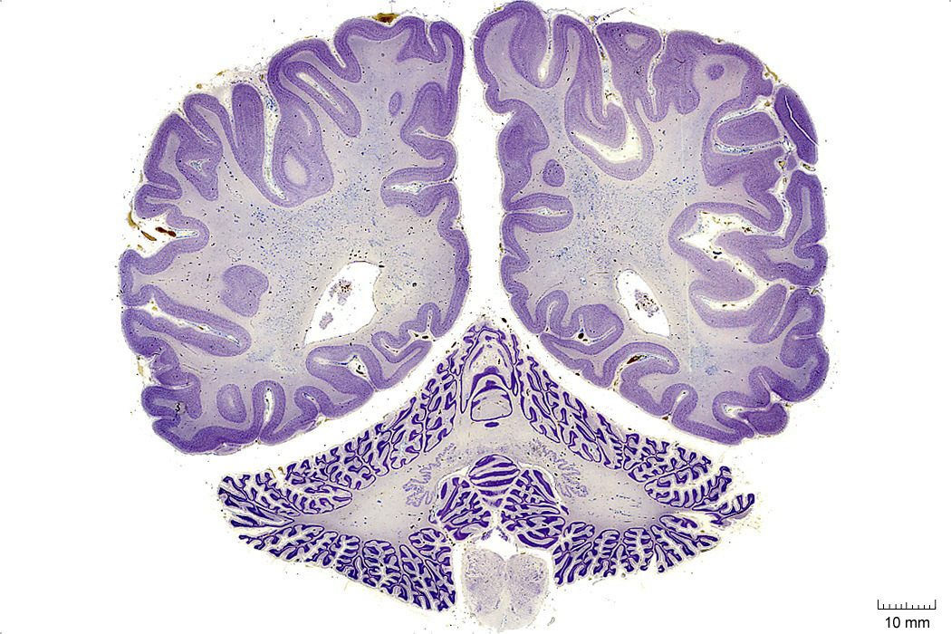 Coronal section from The Human Brain Atlas at the Michigan State University Brain Biodiveristy Bank which acknowledges their support from the National Science Foundation.