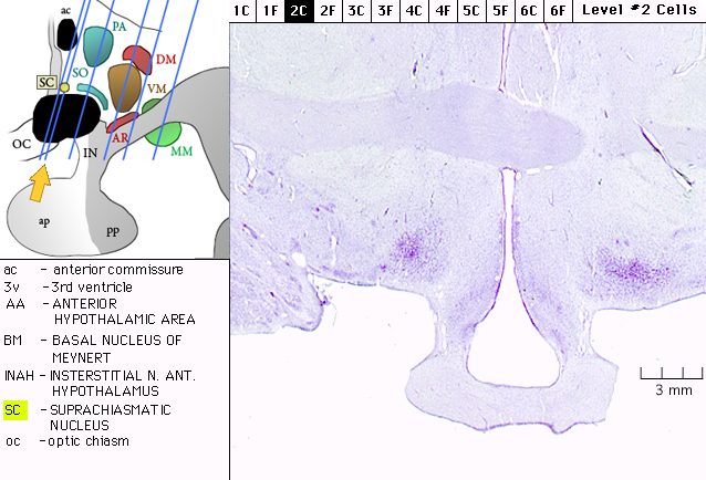 Sagittal section from The Human Brain Atlas at the Michigan State University Brain Biodiveristy Bank which acknowledges their support from the National Science Foundation.