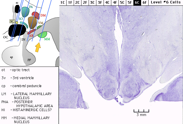 Sagittal section from The Human Brain Atlas at the Michigan State University Brain Biodiveristy Bank which acknowledges their support from the National Science Foundation.