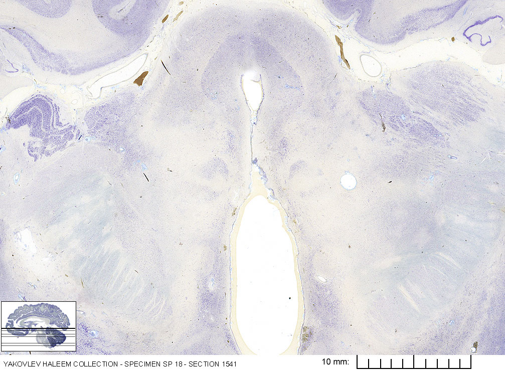 Horizontal section from The Human Brain Atlas at the Michigan State University Brain Biodiveristy Bank which acknowledges their support from the National Science Foundation.