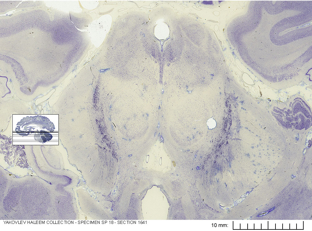 Horizontal section from The Human Brain Atlas at the Michigan State University Brain Biodiveristy Bank which acknowledges their support from the National Science Foundation.