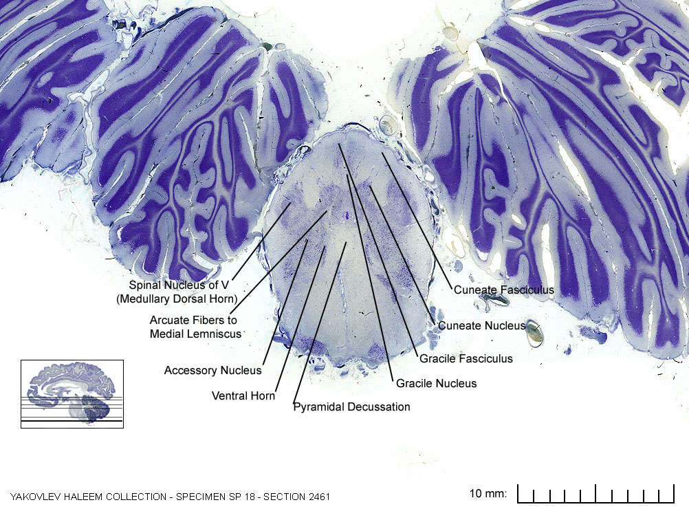 Horizontal section from The Human Brain Atlas at the Michigan State University Brain Biodiveristy Bank which acknowledges their support from the National Science Foundation.