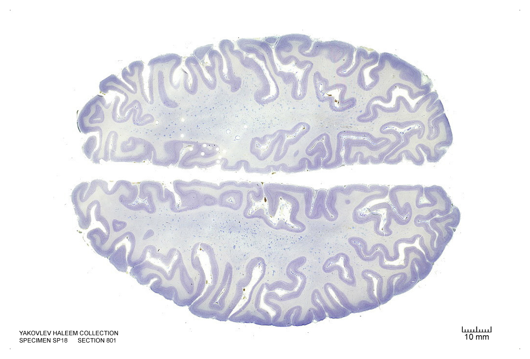 Horizontal section from The Human Brain Atlas at the Michigan State University Brain Biodiveristy Bank which acknowledges their support from the National Science Foundation.