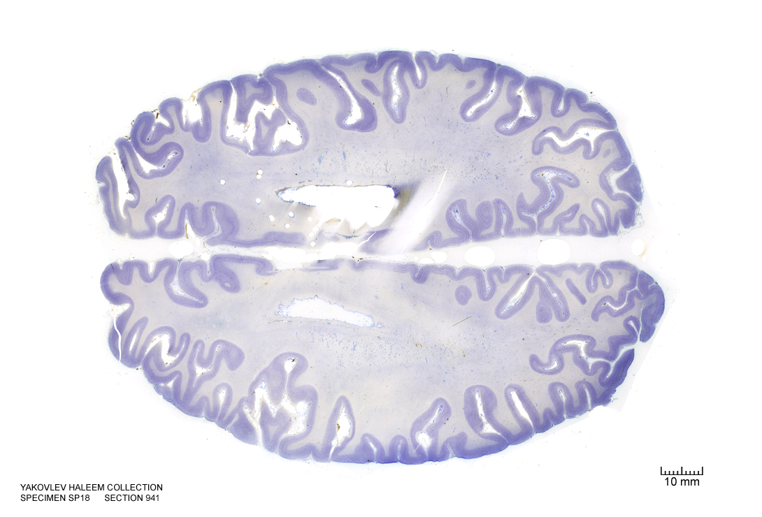 Horizontal section from The Human Brain Atlas at the Michigan State University Brain Biodiveristy Bank which acknowledges their support from the National Science Foundation.