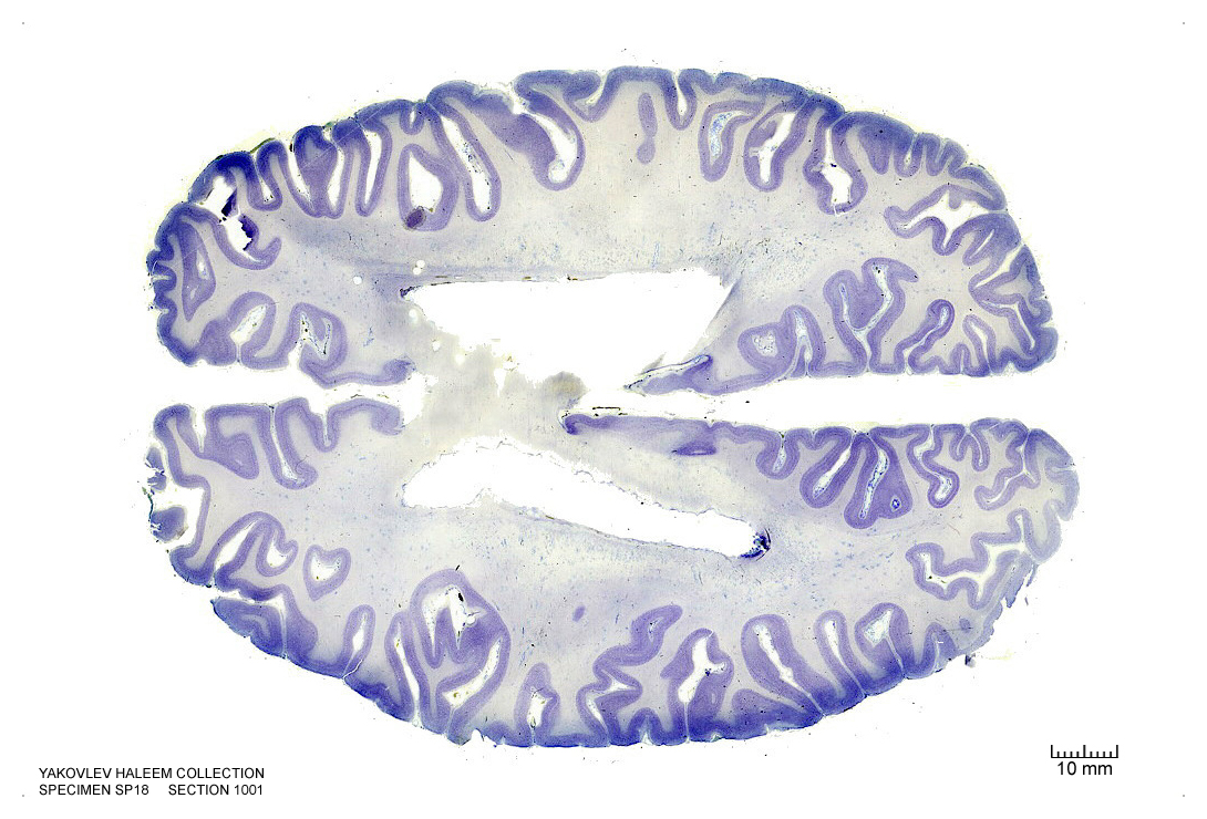 Horizontal section from The Human Brain Atlas at the Michigan State University Brain Biodiveristy Bank which acknowledges their support from the National Science Foundation.