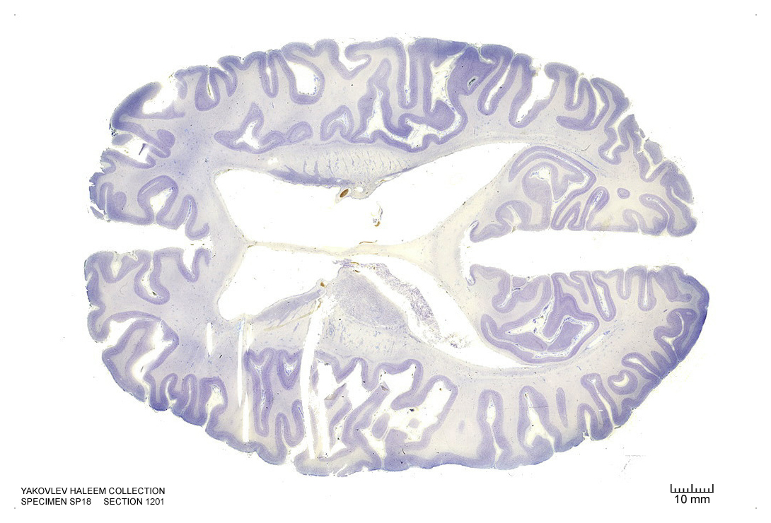 Horizontal section from The Human Brain Atlas at the Michigan State University Brain Biodiveristy Bank which acknowledges their support from the National Science Foundation.