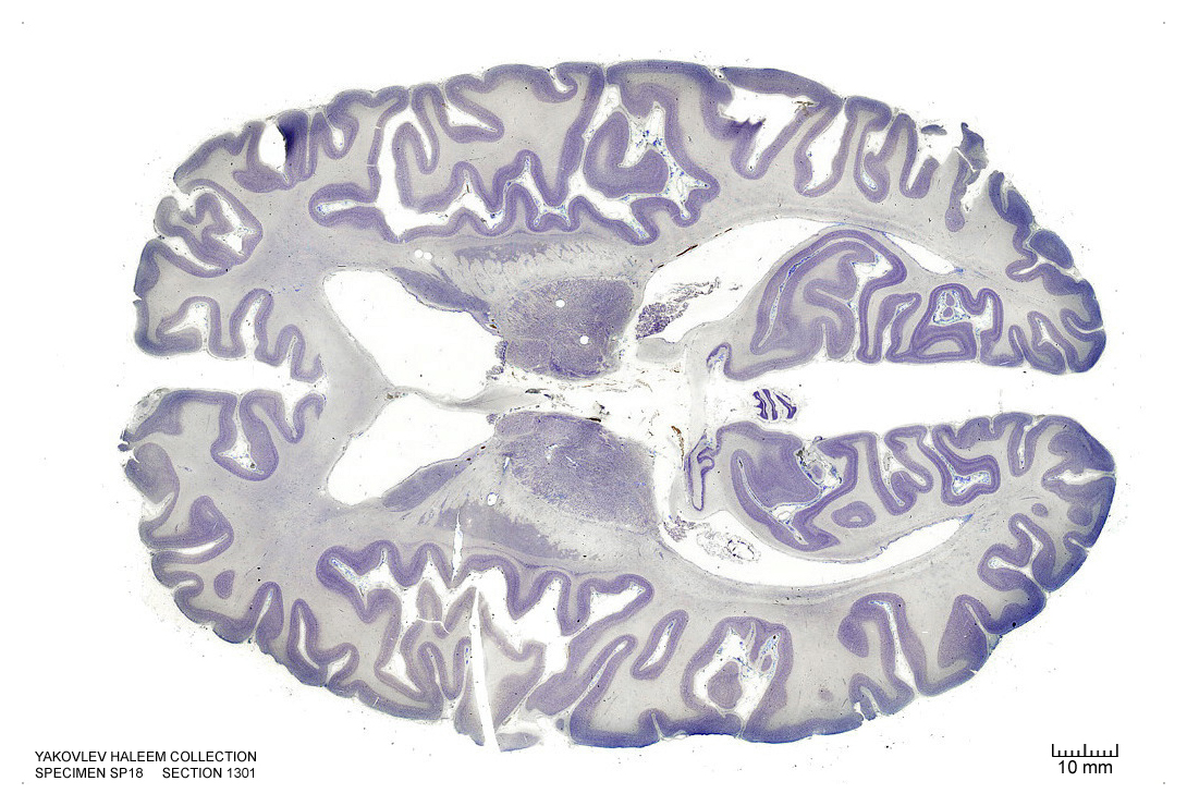 Horizontal section from The Human Brain Atlas at the Michigan State University Brain Biodiveristy Bank which acknowledges their support from the National Science Foundation.