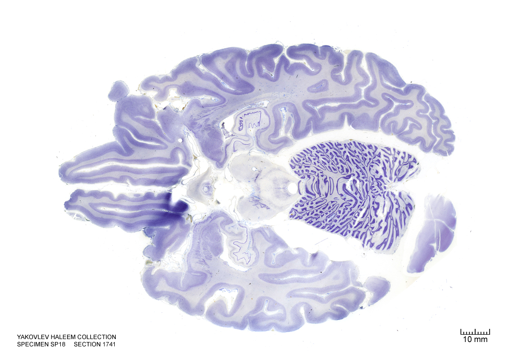 Horizontal section from The Human Brain Atlas at the Michigan State University Brain Biodiveristy Bank which acknowledges their support from the National Science Foundation.