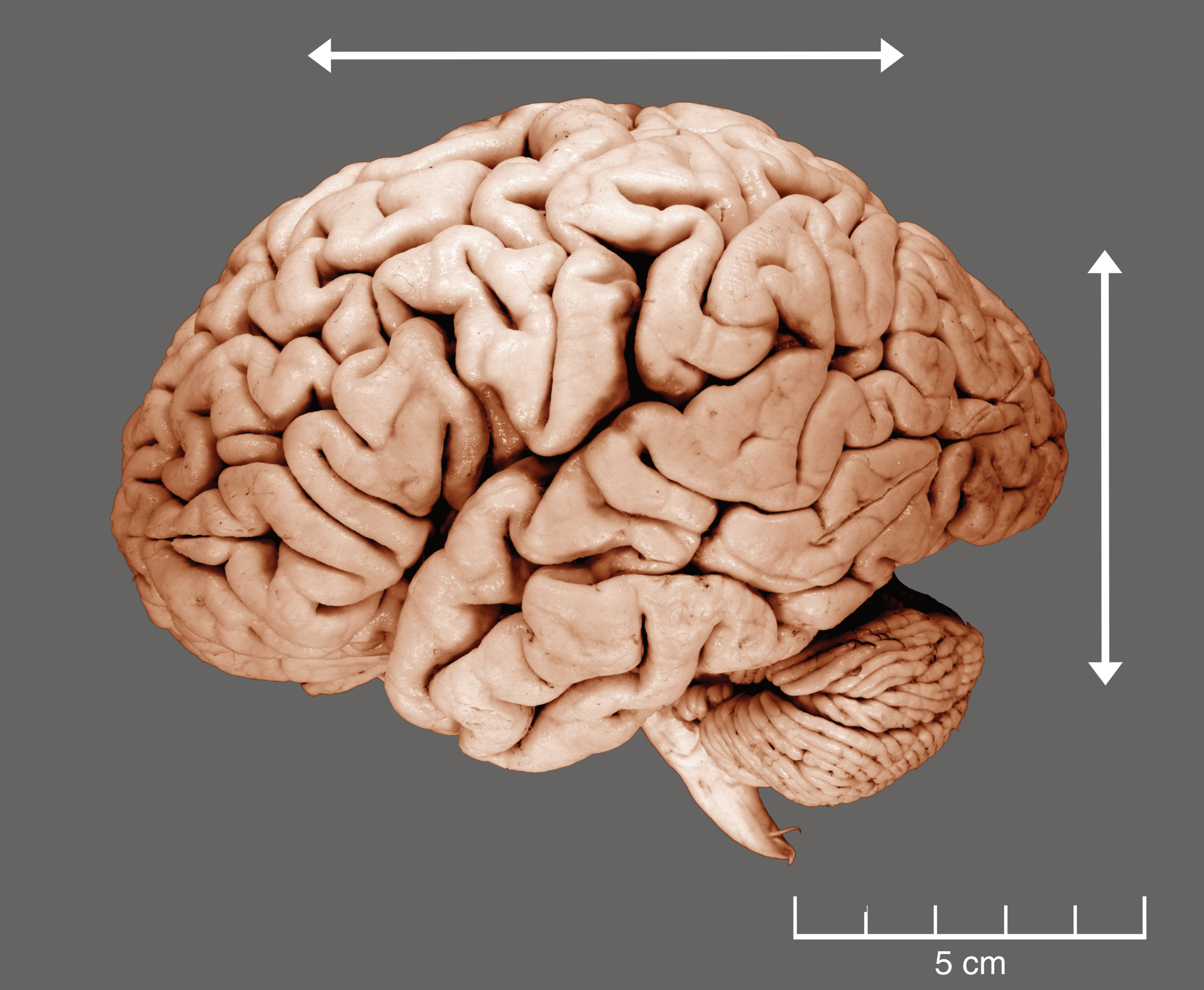 A lateral view of a human brain.