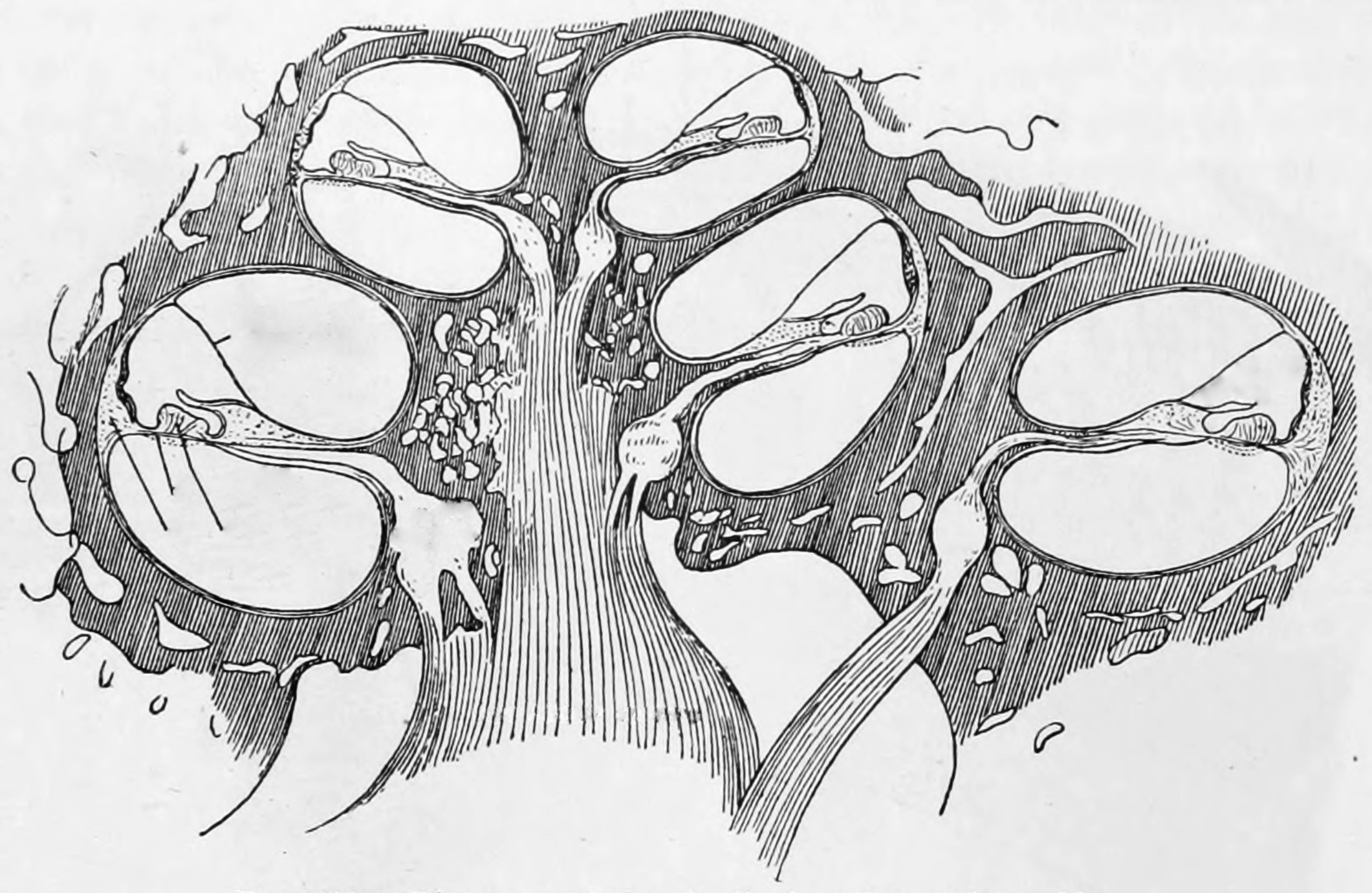 Diagramatic longitudinal section of the cochlea. From Gray Henry, Anatomy of the Human Body. 20th Edition, Lea & Febiger, Philadelphia & New York, 1918