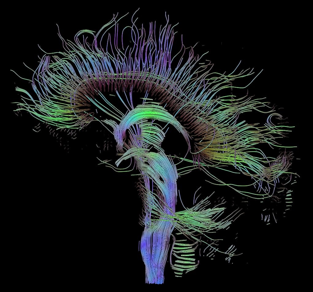 Visualization of a DTI measurement of a human brain. Depicted are reconstructed fiber tracts that run through the mid-sagittal plane. Especially prominent are the U-shaped fibers that connect the two hemispheres through the corpus callosum (the fibers come out of the image plane and consequently bend towards the top) and the fiber tracts that descend toward the spine (blue, within the image plane)