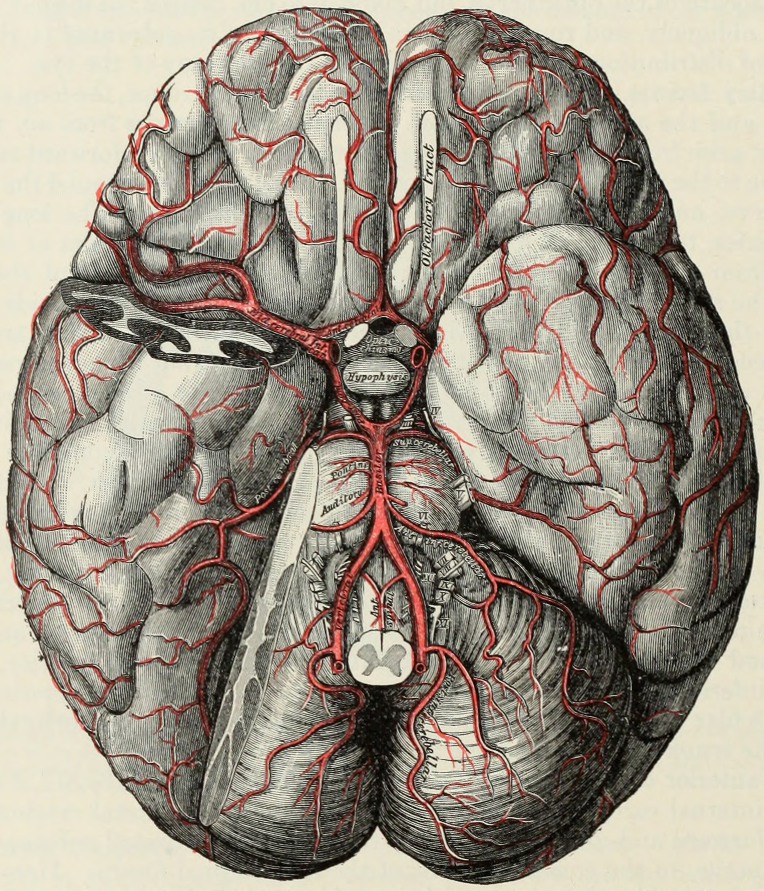 The arteries of the base of the brain. The tempora pole of the cerebrum and a portion of the cerebellar hemisphere have been removed on the right side. From Gray Henry, Anatomy of the Human Body. 20th Edition, Lea & Febiger, Philadelphia & New York, 1918
