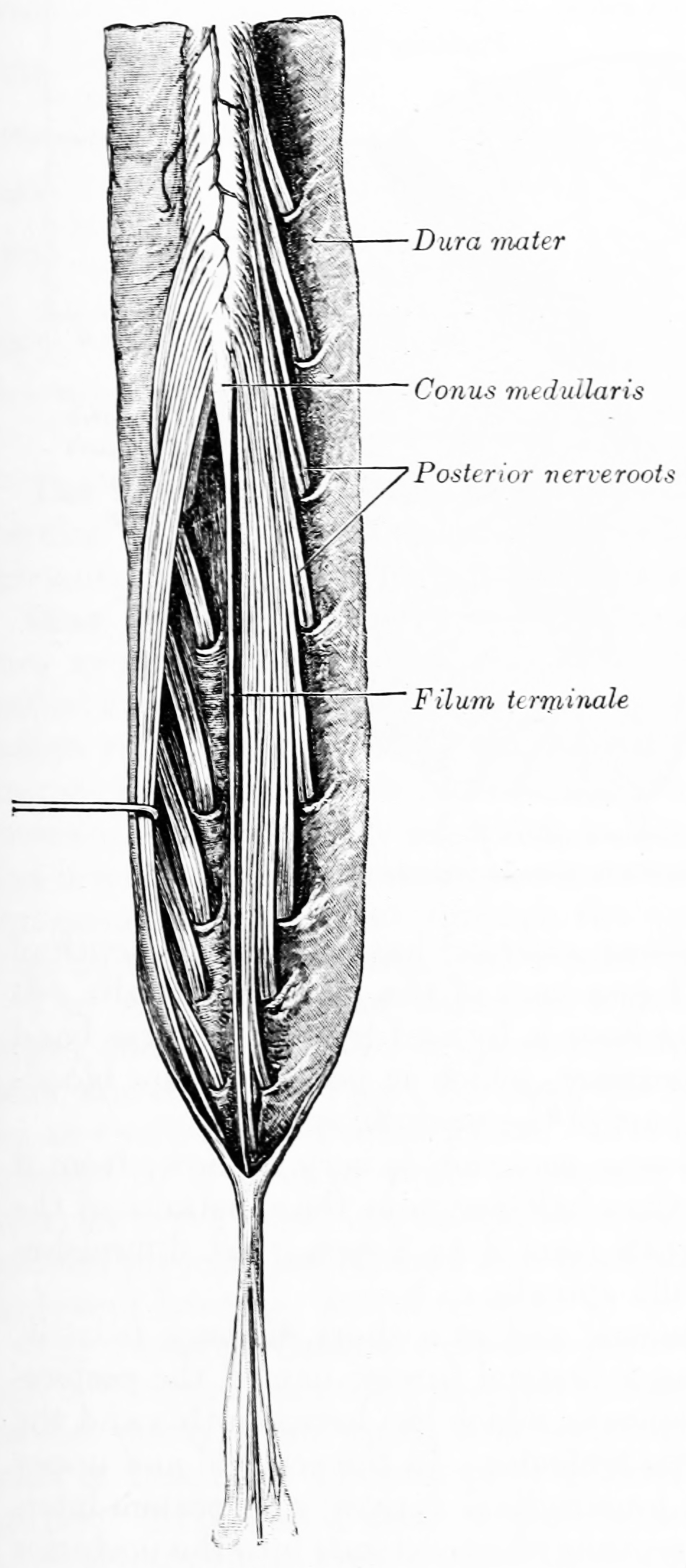 Cauda equina and filum terminale seen from behind. The dura mater has been opened and spread out, and the arachnoid has been removed. From Gray Henry, Anatomy of the Human Body. 20th Edition, Lea & Febiger, Philadelphia & New York, 1918