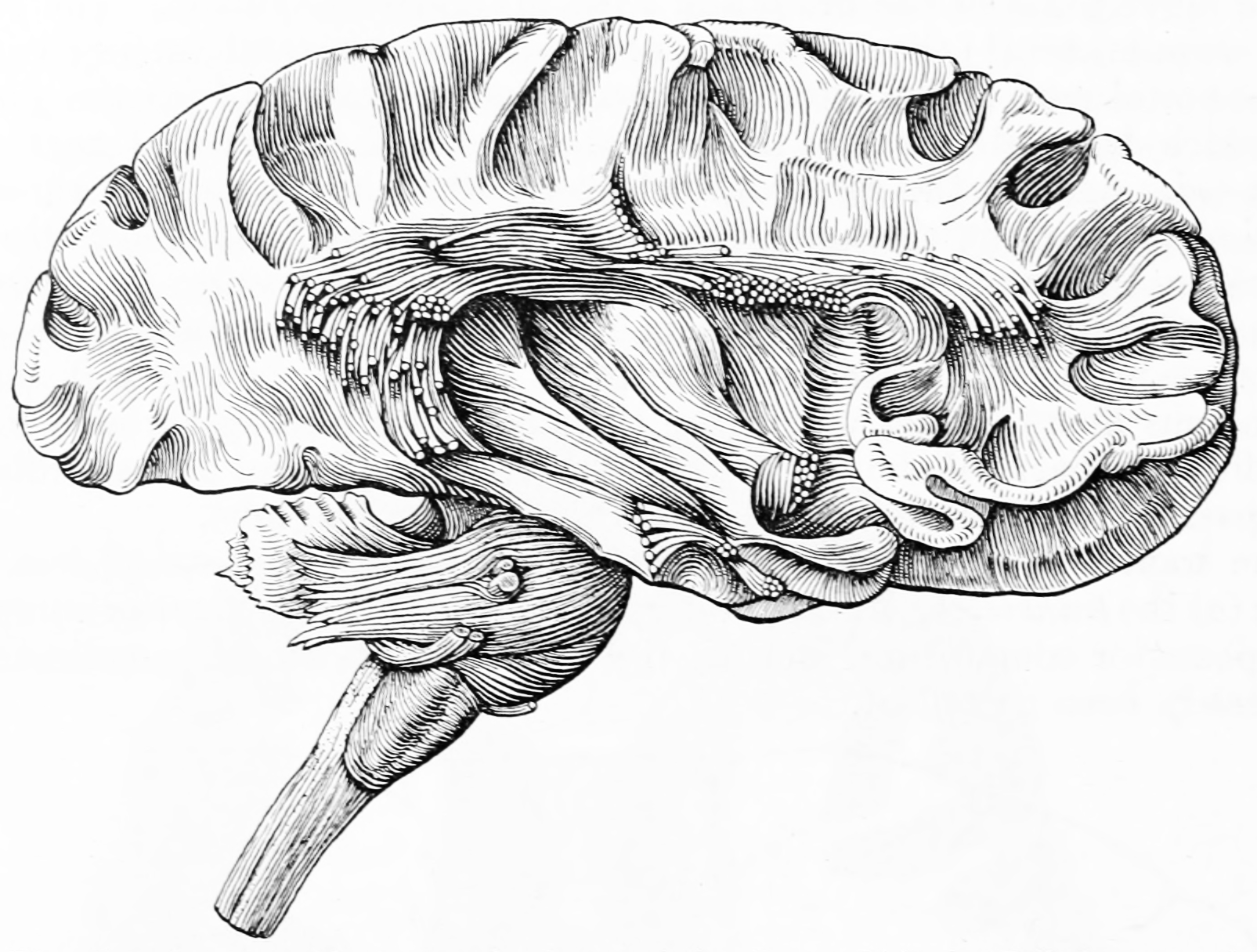 Dissection of cortex and brainstem showing association fibers after removing of the gray matter. From Gray Henry, Anatomy of the Human Body. 20th Edition, Lea & Febiger, Philadelphia & New York, 1918