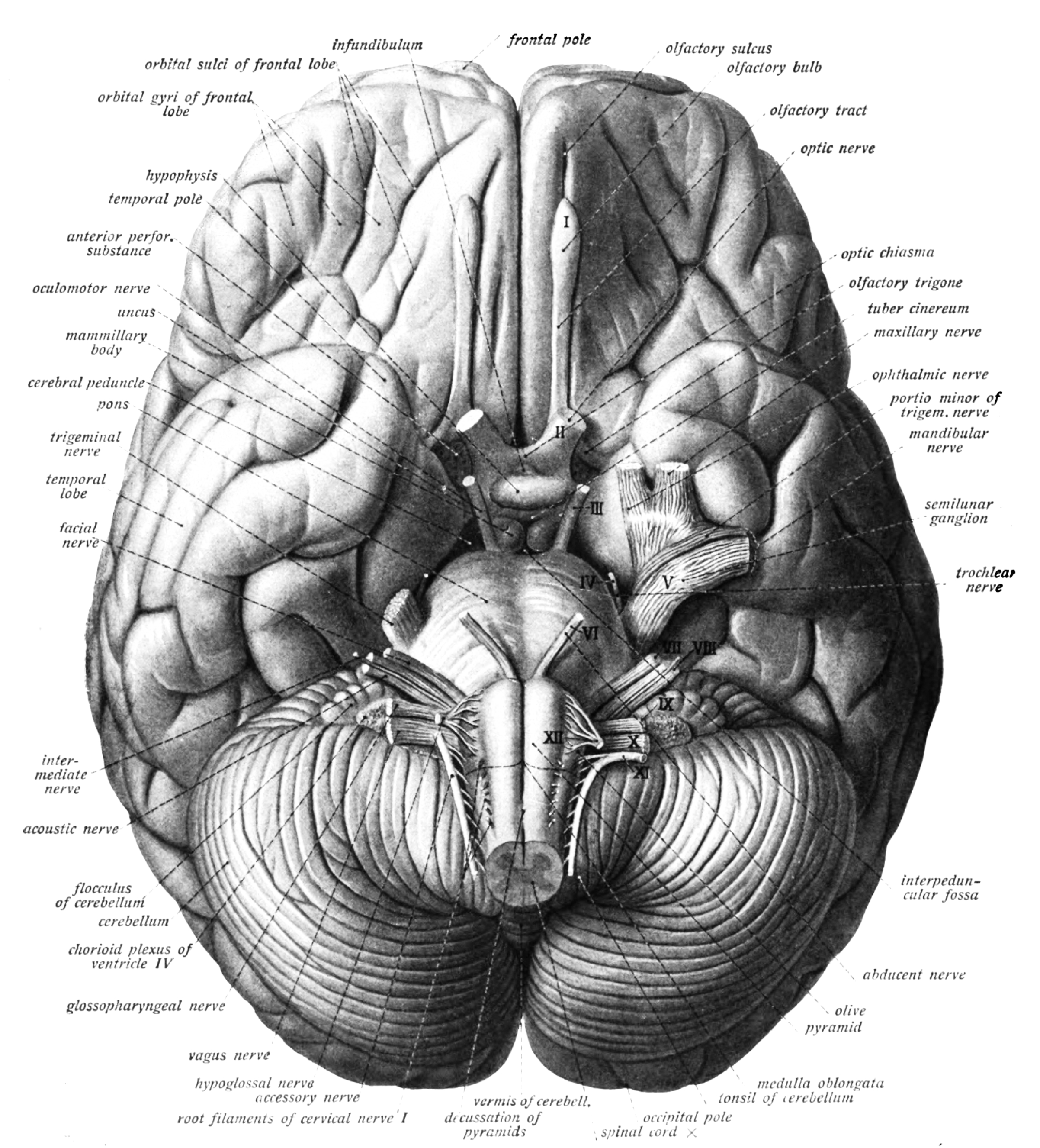 Bottom view of the human brain. Sobotta’s Textbook and Atlas of Human Anatomy 1909