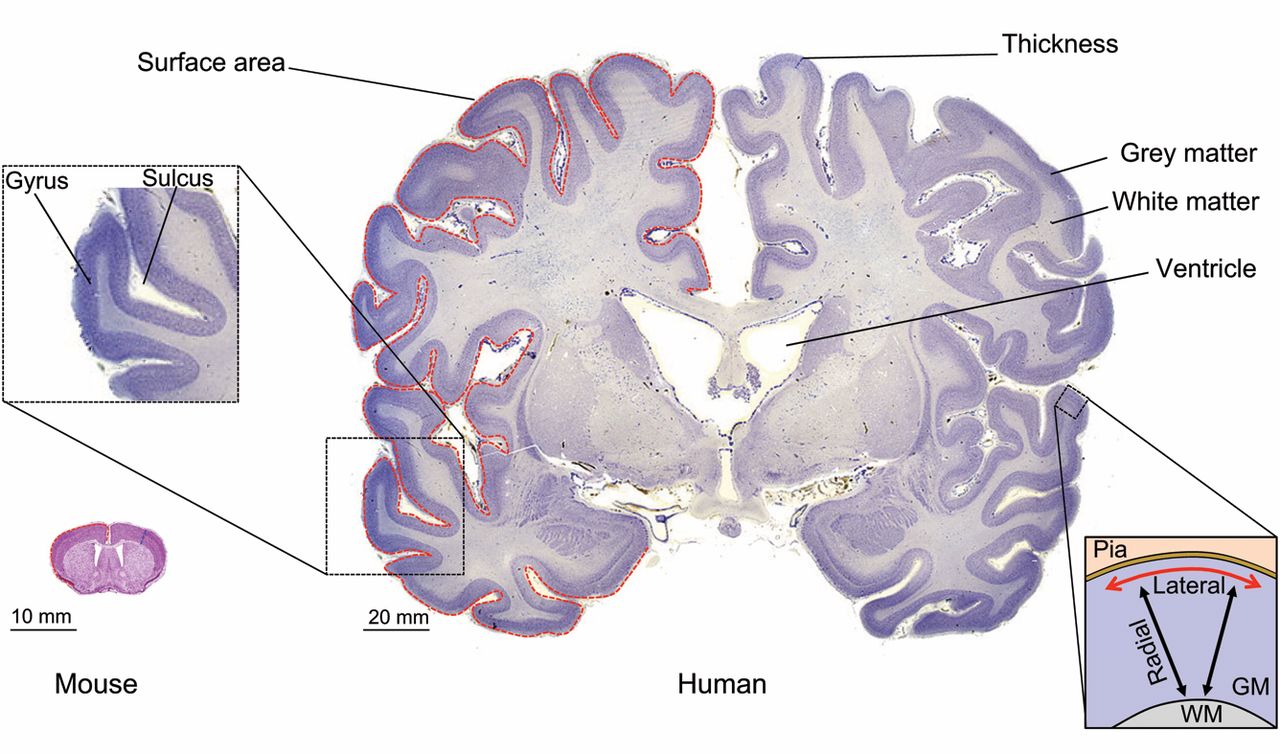 Neocortex morphology. Coronal sections of the mouse (left) and human (right) adult neocortex are shown. Red dashed lines highlight the contour of the pial surface of the gray matter (GM). Blue dashed lines highlight neocortical thickness. The inset on the left shows an area of the human neocortex at higher magnification, highlighting a neocortical gyrus that is contiguous to a sulcus. The inset on the right outlines the principal dimensions by which the adult neocortical GM is described: (1) radial (black arrows), i.e. along the white matter (WM)-to-pia axis, corresponding to the apical-basal axis in terms of tissue polarity; and (2) lateral (red arrow), i.e. along the axis perpendicular to the radial axis. Mouse neocortex adapted with permission from the High Resolution Mouse Brain Atlas (Sidman, R. L., Kosaras, B., Misra, B. M. and Senft, S. L., 1999), http://www.hms.harvard.edu/research/brain; human neocortex adapted with permission from http://www.brains.rad.msu.edu and http://brainmuseum.org (supported by the US National Science Foundation). From Marta Florio, Wieland B. Huttner(2014) Neural progenitors, neurogenesis and the evolution of the neocortex Development 2014 141: 2182-2194; doi: 10.1242/dev.090571