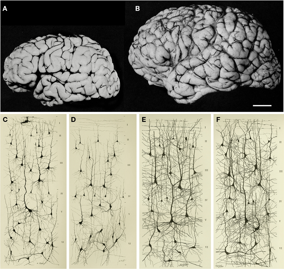 Increase in brain size and the maturation of cortical circuits. The maturation of mental processes and motor skills is associated with an approximately fourfold enlargement in brain size. (A,B) photographs of the brains of a 1-month and 6-year-old-child. This increment is accompanied by a dramatic development in the complexity of the neuronal processes, which in turn is influenced by the genetic background and the environment. This increase in the complexity is clearly evident in the drawings of Golgi stained cortical neurons from the cerebral cortex of a 1-month [(C) “pars triangularis of gyrus frontalis inferior”; (D) “orbital gyrus”] and 6 year [(e), “pars triangularis of gyrus frontalis inferior”; (F) “orbital gyrus”] old child. Adapted from Conel and Le (1941, 1967). Scale bar for (A,B): 2 cm. From DeFelipe J (2011) The evolution of the brain, the human nature of cortical circuits, and intellectual creativity. Front. Neuroanat. 5:29