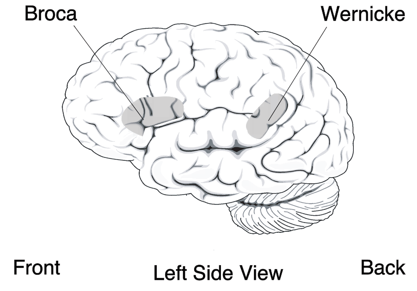 Cortical areas damaged in Broaca’s and Wernicke’s aphasia.